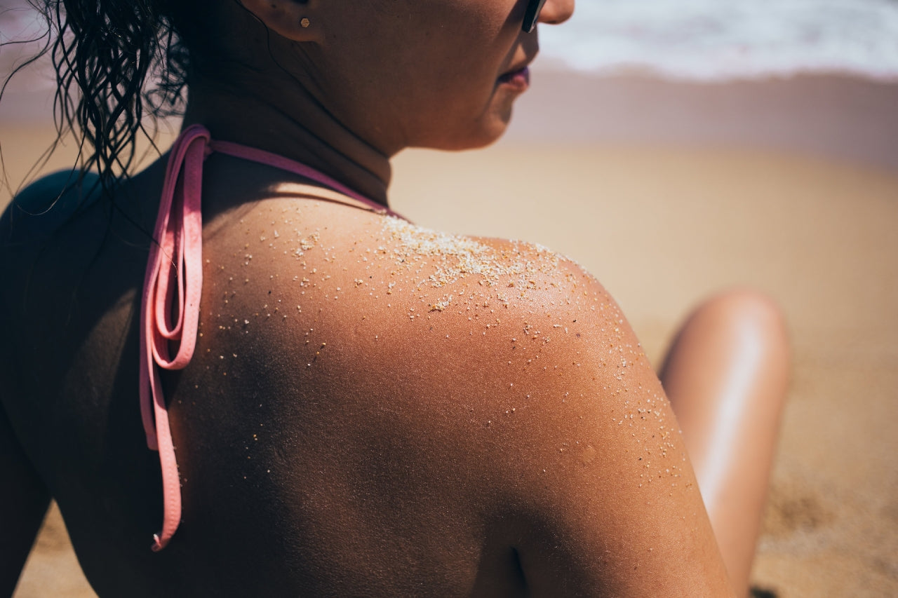 Can You Put Fake Tan on Sunburn?