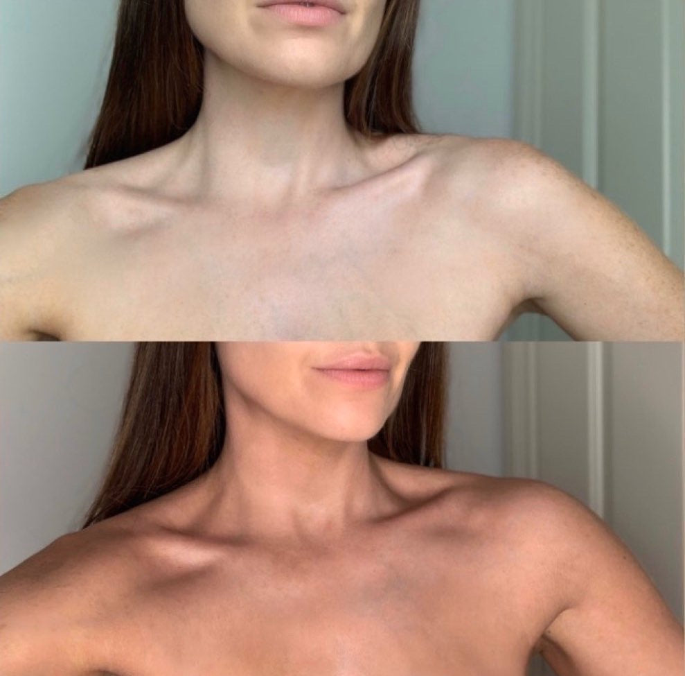 Self Tanning Mousse | Before & After