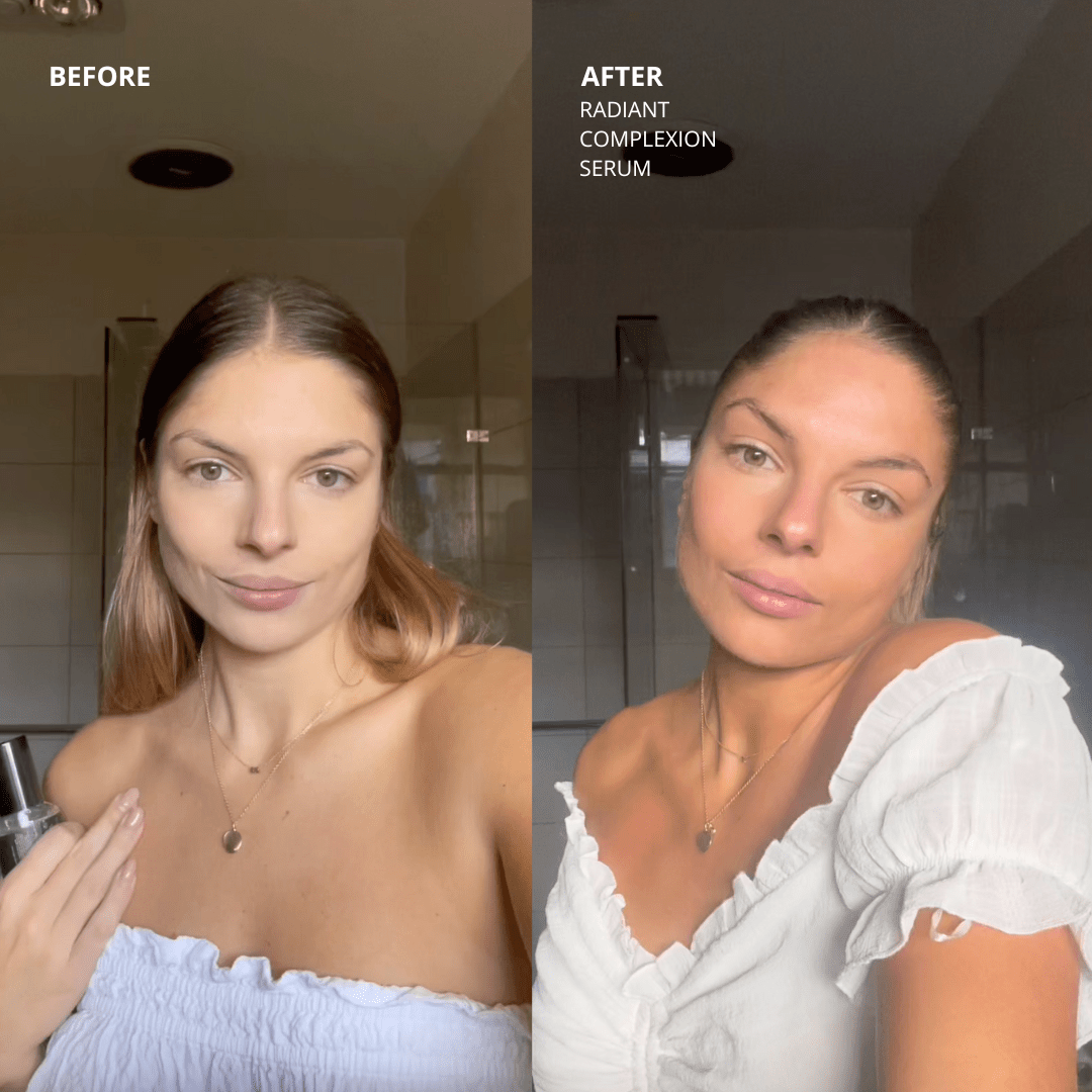 Radiant Complexion Serum By Sonia Kruger | Before & After