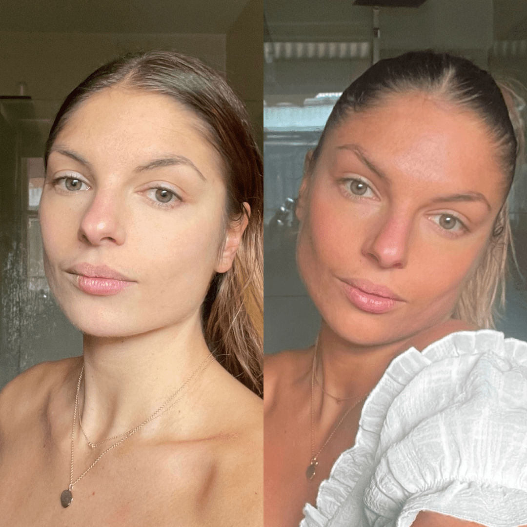 Radiant Complexion Serum By Sonia Kruger | Before & After